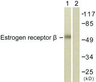 Anti-Estrogen Receptor-&#946; antibody produced in rabbit affinity isolated antibody