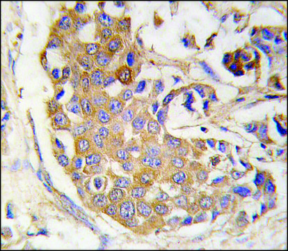 Anti-SOX1 (center) antibody produced in rabbit saturated ammonium sulfate (SAS) precipitated, buffered aqueous solution