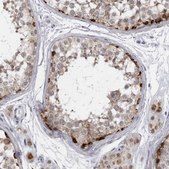 Anti-SLC25A22 antibody produced in rabbit Prestige Antibodies&#174; Powered by Atlas Antibodies, affinity isolated antibody, buffered aqueous glycerol solution