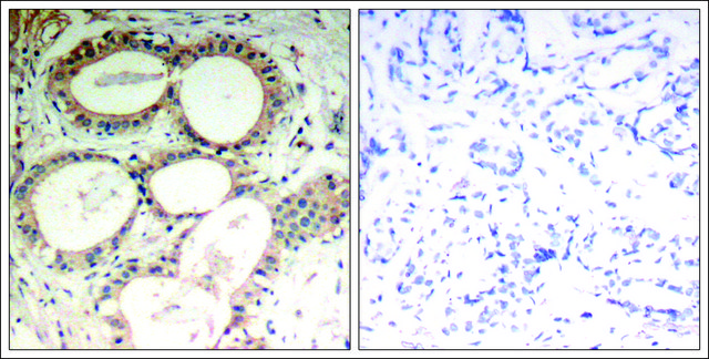 Anti-NFKBIE (Ab-22) antibody produced in rabbit affinity isolated antibody