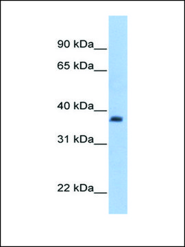 Anti-ST3GAL2 antibody produced in rabbit affinity isolated antibody