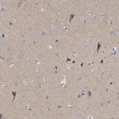 Anti-GDAP1 antibody produced in rabbit Prestige Antibodies&#174; Powered by Atlas Antibodies, affinity isolated antibody, buffered aqueous glycerol solution