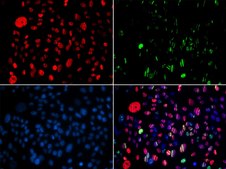 Anti-Phospho-SMC1A-S957 antibody produced in rabbit