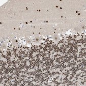 Anti-H2AFY2 antibody produced in rabbit Prestige Antibodies&#174; Powered by Atlas Antibodies, affinity isolated antibody, buffered aqueous glycerol solution