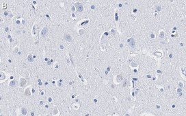 Anti-CD56 Antibody, clone 3F5 ZooMAb&#174; Rabbit Monoclonal recombinant, expressed in HEK 293 cells