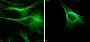 Monoclonal Anti-&#946;-Tubulin antibody produced in mouse clone TUB 2.1, ascites fluid