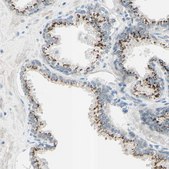 Anti-B4GALT1 antibody produced in rabbit Ab1, Prestige Antibodies&#174; Powered by Atlas Antibodies, affinity isolated antibody, buffered aqueous glycerol solution