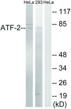Anti-ATF2 antibody produced in rabbit affinity isolated antibody