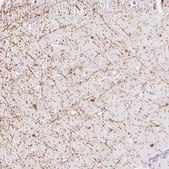Anti-MBP antibody produced in rabbit Prestige Antibodies&#174; Powered by Atlas Antibodies, affinity isolated antibody, buffered aqueous glycerol solution