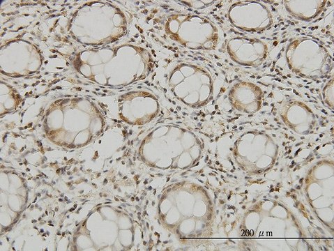 Monoclonal Anti-MTSS1 antibody produced in mouse clone 2G9, purified immunoglobulin, buffered aqueous solution