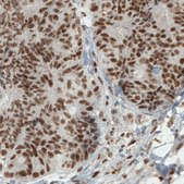 Monoclonal Anti-ERCC1 antibody produced in mouse Prestige Antibodies&#174; Powered by Atlas Antibodies, clone CL1284, purified immunoglobulin, buffered aqueous glycerol solution