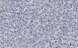 Anti-Haptoglobin Antibody, clone 2D22 ZooMAb&#174; Rabbit Monoclonal recombinant, expressed in HEK 293 cells