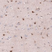 Monoclonal Anti-CHI3L1 antibody produced in mouse Prestige Antibodies&#174; Powered by Atlas Antibodies, clone CL12314, purified immunoglobulin, buffered aqueous glycerol solution