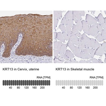 Anti-KRT13 antibody produced in rabbit Prestige Antibodies&#174; Powered by Atlas Antibodies, affinity isolated antibody, buffered aqueous glycerol solution