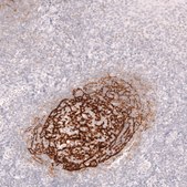 Monoclonal Anti-Cr2 Antibody Produced In Mouse Prestige Antibodies&#174; Powered by Atlas Antibodies, clone CL14556, affinity isolated antibody, buffered aqueous glycerol solution