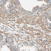 Anti-PI4K2B antibody produced in rabbit Prestige Antibodies&#174; Powered by Atlas Antibodies, affinity isolated antibody, buffered aqueous glycerol solution