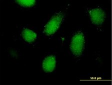 Anti-RSC1A1 antibody produced in mouse purified immunoglobulin, buffered aqueous solution