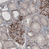 Monoclonal Anti-LAMC1 antibody produced in mouse Prestige Antibodies&#174; Powered by Atlas Antibodies, clone CL3195, purified immunoglobulin, buffered aqueous glycerol solution