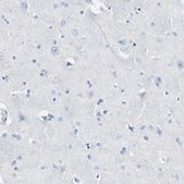 Anti-LAG3 antibody produced in rabbit Prestige Antibodies&#174; Powered by Atlas Antibodies, affinity isolated antibody, buffered aqueous glycerol solution