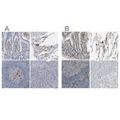 Anti-SKAP2 antibody produced in rabbit Prestige Antibodies&#174; Powered by Atlas Antibodies, affinity isolated antibody, buffered aqueous glycerol solution
