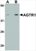 Anti-AGTR1 antibody produced in rabbit affinity isolated antibody, buffered aqueous solution