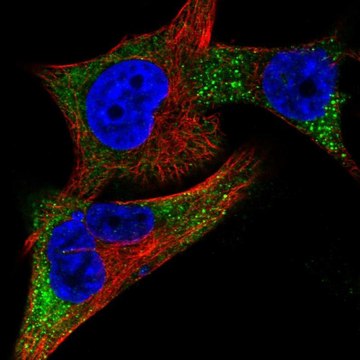 Anti-TYR antibody produced in rabbit Prestige Antibodies&#174; Powered by Atlas Antibodies, affinity isolated antibody