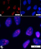 BioTracker&#8482; rRNA Live Cell Probe Fluorescent detection of ribosomal RNA and cell nucleoli