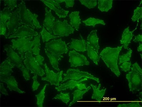 Monoclonal Anti-KRAS antibody produced in mouse clone 3B10-2F2, purified immunoglobulin, buffered aqueous solution