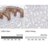Anti-LY6D antibody produced in rabbit Prestige Antibodies&#174; Powered by Atlas Antibodies, affinity isolated antibody, buffered aqueous glycerol solution