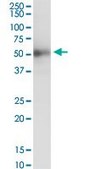 ANTI-ISLR antibody produced in mouse purified immunoglobulin, buffered aqueous solution