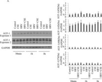 Anti-AUF1 Antibody Upstate&#174;, from rabbit
