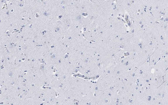 Anti-Neurofilament H Antibody, clone 5L10, ZooMAb&#174; Rabbit Monoclonal recombinant, expressed in HEK 293 cells