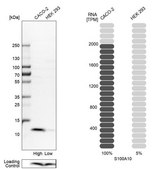 Anti-S100A10 antibody produced in rabbit Prestige Antibodies&#174; Powered by Atlas Antibodies, affinity isolated antibody, buffered aqueous glycerol solution