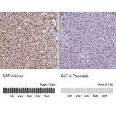 Anti-CAT antibody produced in rabbit Prestige Antibodies&#174; Powered by Atlas Antibodies, affinity isolated antibody, buffered aqueous glycerol solution