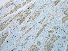 Anti-GLI2 affinity isolated antibody