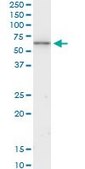 Monoclonal Anti-KRT6B antibody produced in mouse clone 4G9, purified immunoglobulin, buffered aqueous solution