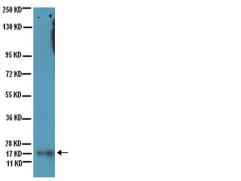 Anti-acetyl-Lysine Antibody, clone 4G12 clone 4G12, Upstate&#174;, from mouse