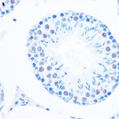 Anti-DNA Polymerase beta antibody produced in rabbit