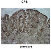Anti-CPS1 (AB2) antibody produced in rabbit IgG fraction of antiserum