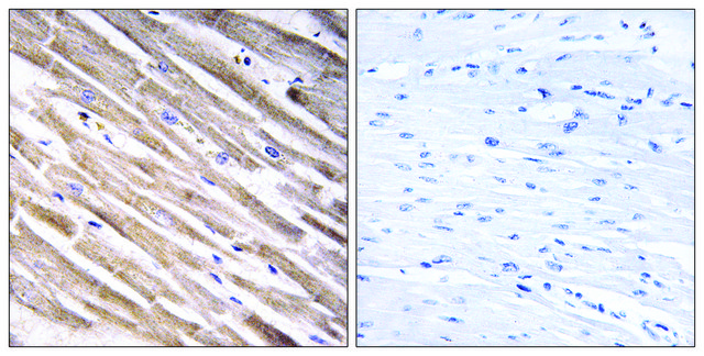 Anti-RPL3L antibody produced in rabbit affinity isolated antibody