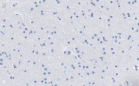 Anti-KCNQ2 Antibody, clone 2G18 ZooMAb&#174; Rabbit Monoclonal recombinant, expressed in HEK 293 cells