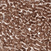 Monoclonal Anti-AMACR antibody produced in mouse Prestige Antibodies&#174; Powered by Atlas Antibodies, clone CL9362, purified immunoglobulin, buffered aqueous glycerol solution