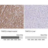 Anti-TNNT2 antibody produced in rabbit Prestige Antibodies&#174; Powered by Atlas Antibodies, affinity isolated antibody, buffered aqueous glycerol solution