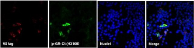 Anti-C9ORF72 (&#945;-GR sense Antibody, CT) serum, from rabbit