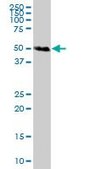 Anti-CFI antibody produced in mouse purified immunoglobulin, buffered aqueous solution
