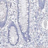 Anti-CSN3 antibody produced in rabbit Prestige Antibodies&#174; Powered by Atlas Antibodies, affinity isolated antibody, buffered aqueous glycerol solution
