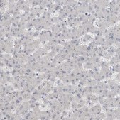 Anti-ADAM2 antibody produced in rabbit Prestige Antibodies&#174; Powered by Atlas Antibodies, affinity isolated antibody, buffered aqueous glycerol solution, Ab2