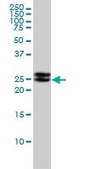 Monoclonal Anti-EPDR1 antibody produced in mouse clone 1C1, purified immunoglobulin, buffered aqueous solution