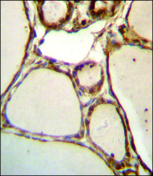 ANTI-HJURP (C-TERM) antibody produced in rabbit IgG fraction of antiserum, buffered aqueous solution