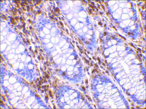 Anti-OMI (ab2) antibody produced in rabbit affinity isolated antibody, buffered aqueous solution